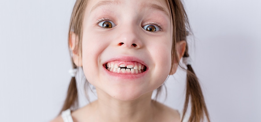 Tanden wisselen: wanneer wisselen kinderen?