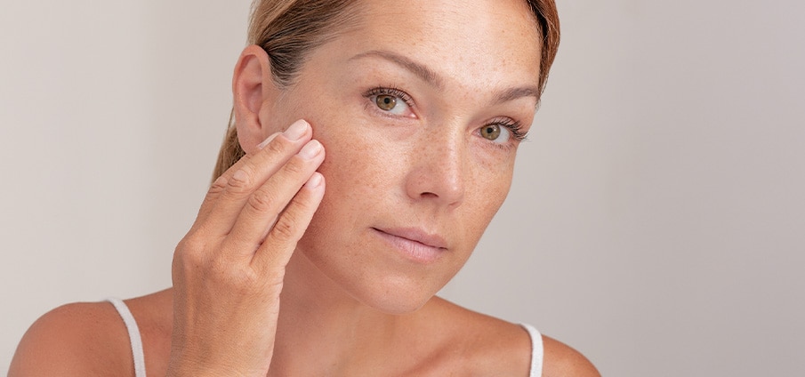 Zwangerschapsmasker: wat doen bij melasma? Zwangerschapsmasker: wat doen bij melasma?