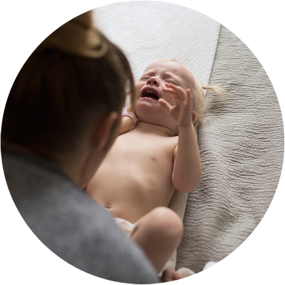 Productbeeld_202248BA2-Koemelkallergie-baby.png Productbeeld_202248BA2-Koemelkallergie-baby.png