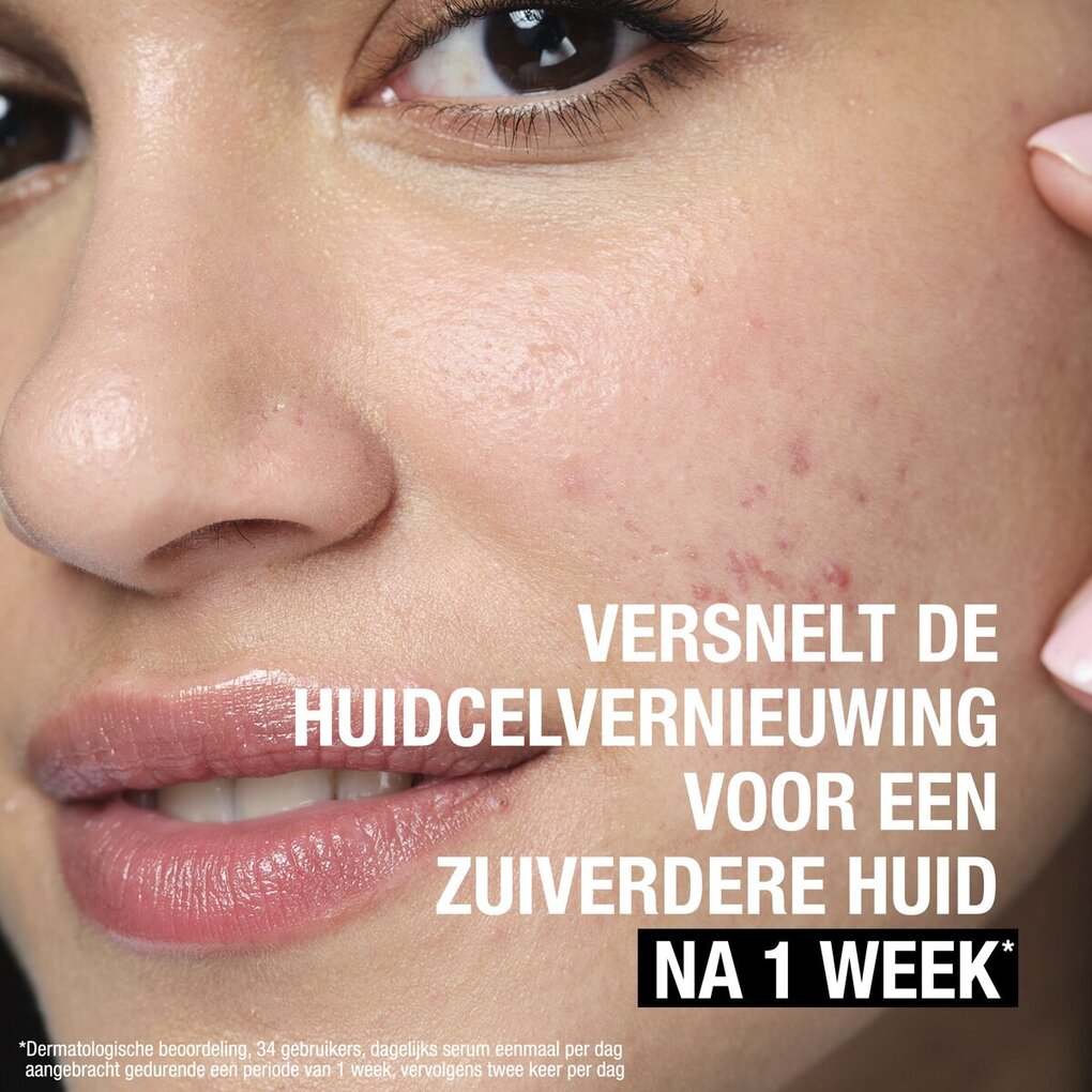 Neutrogena Anti-Puistjes+ 7% AHA Parfumvrije Vloeibare Exfoliant