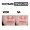 Neutrogena Clear & Defend Peeling Wasgel