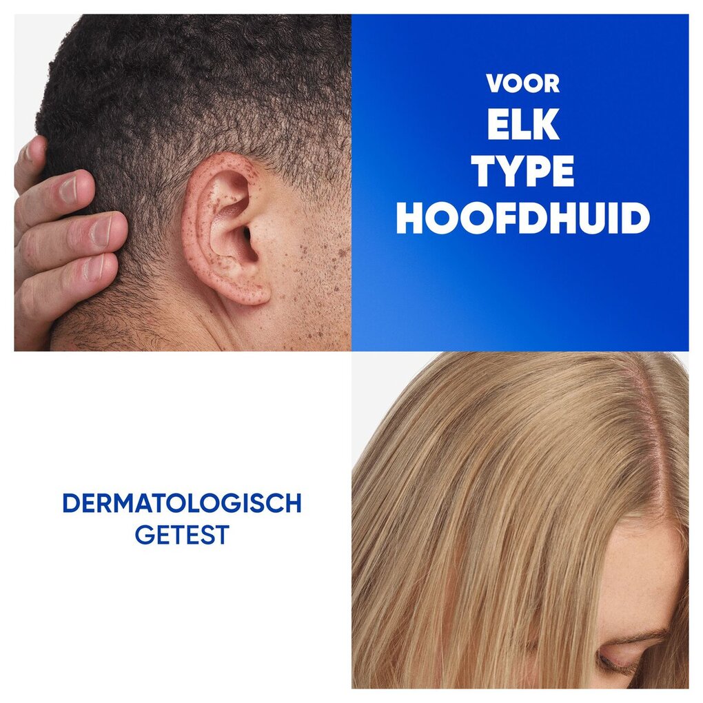 Head & Shoulders Jeukende Hoofdhuid 2-in-1 Antiroosshampoo