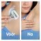 Gillette Venus Party Edition Navulmesjes