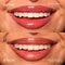 NYX Professional Makeup Lip IV 08 Drippin' In Rose Hydraterende Lipgloss