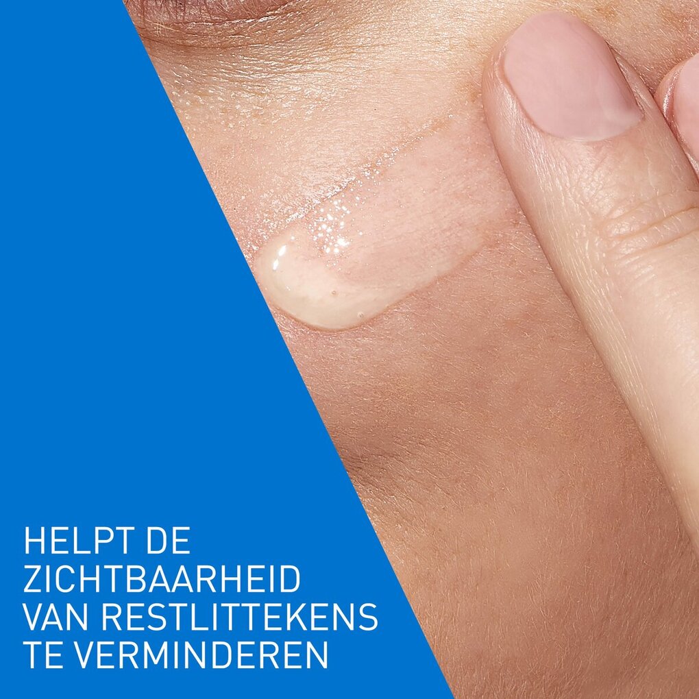 CeraVe Retinol Serum Tegen Post-Acne Vlekjes