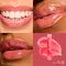 NYX Professional Makeup Jelly Job Kissed Lipgloss